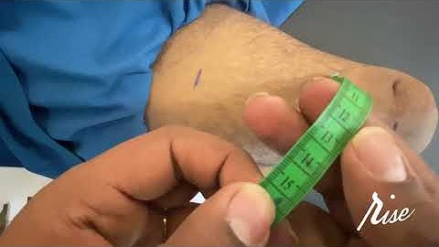 Above Knee Silicone Liner Measurement technique video