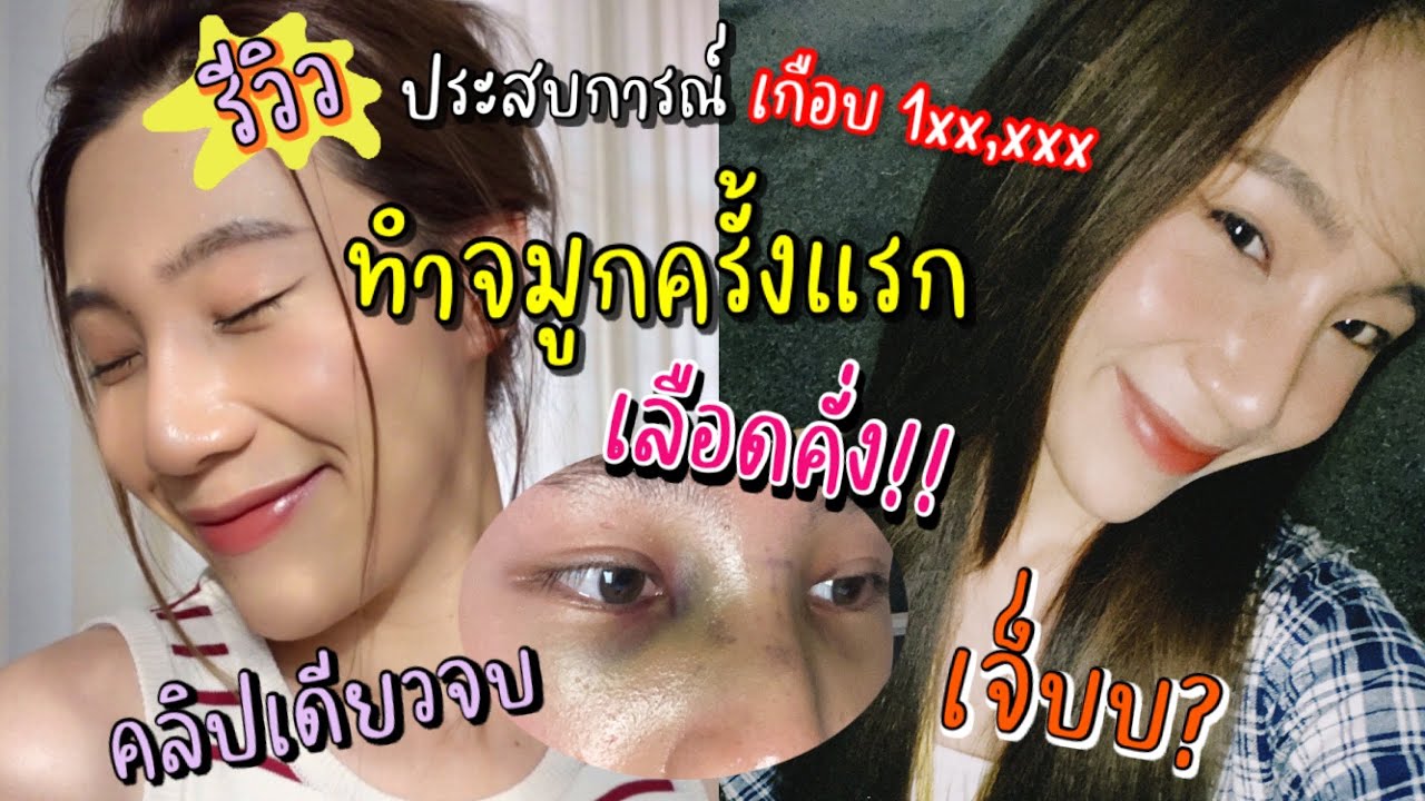 รีวิวพลีชีพ!!ทำจมูกครั้งแรกใครบอกไม่เจ็บบ!😭 ตลอด 2 อาทิตย์ เทคนิค? ดูแลข้อห้าม! | rrommanee