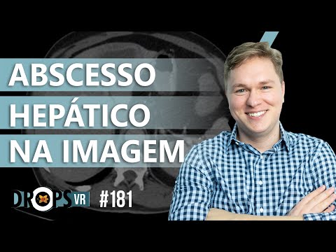 ABSCESSO HEPÁTICO NA IMAGEM - IDENTIFICANDO NA TC