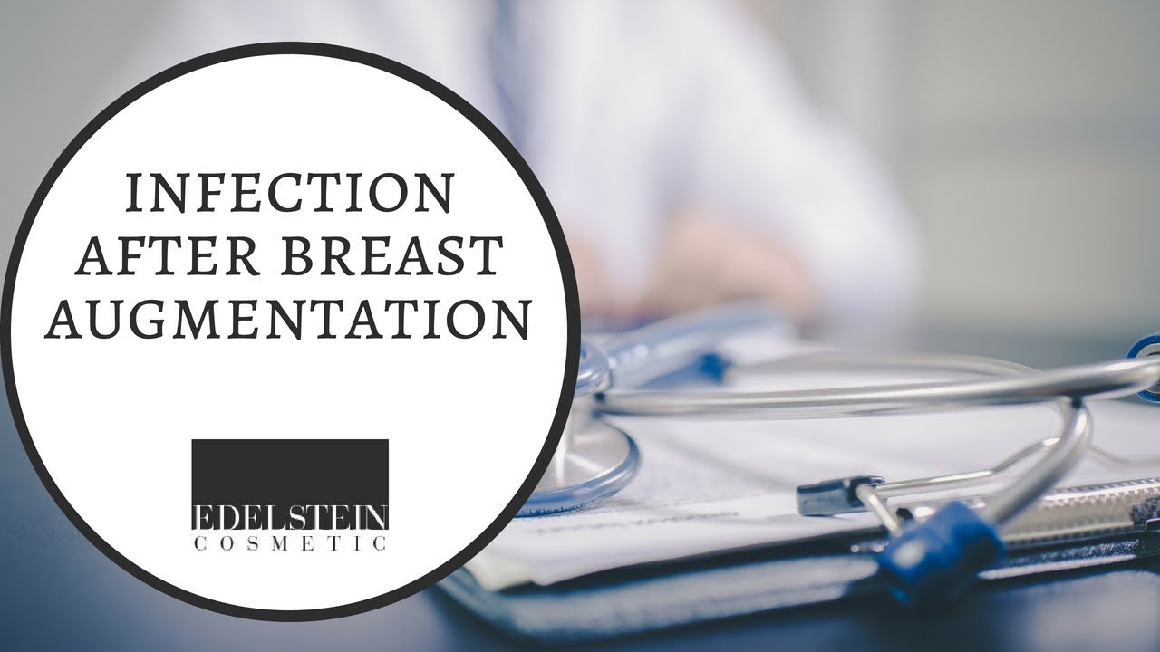 Infection After Breast Augmentation Edelstein Cosmetic YouTube