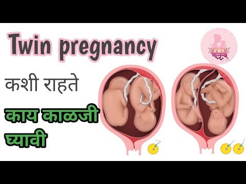 जुळी मुले का होतात | Twin pregnancy madhe kay kalji ghyavi | twin pregnancy care in marathi