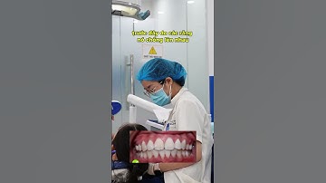 Niềng răng xong tam giác đen có tự biến mất?