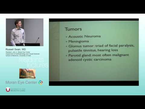 Cranial VII Disorders