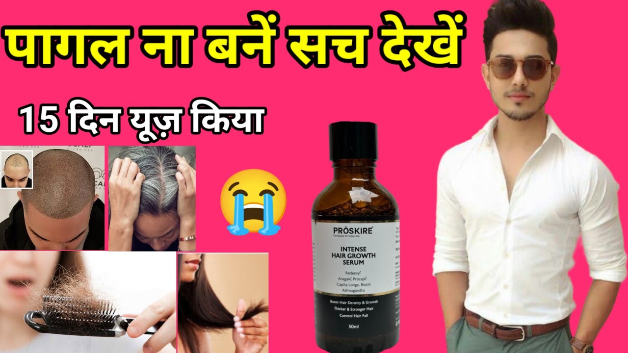 Proskire Intense Hair Growth Serum Review,Proskire Hair Growth Serum 2024,Best Hair Growth Oil