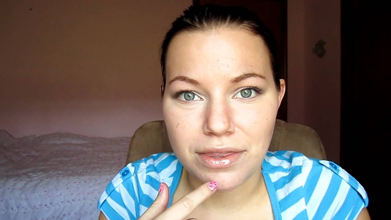 Power Chains/ NO MORE GAP/ 2nd braces tightening ) YouTube