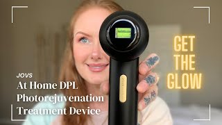 Vanish Dark Spots & Spider Veins With JOVS Device #brightskin #glowingskin