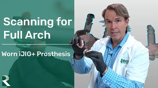 Scanning for Full Arch - Worn iJIG+ Prosthesis