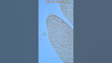 Germs vs Garlic under the Microscope. Powerful! #shorts