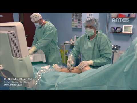 ANTES Plus - 12 rokov jednodňovej chirurgie v Michalovciach