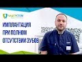 Имплантация зубов при полном отсутствии зубов. 😷 Полная имплантация зубов.