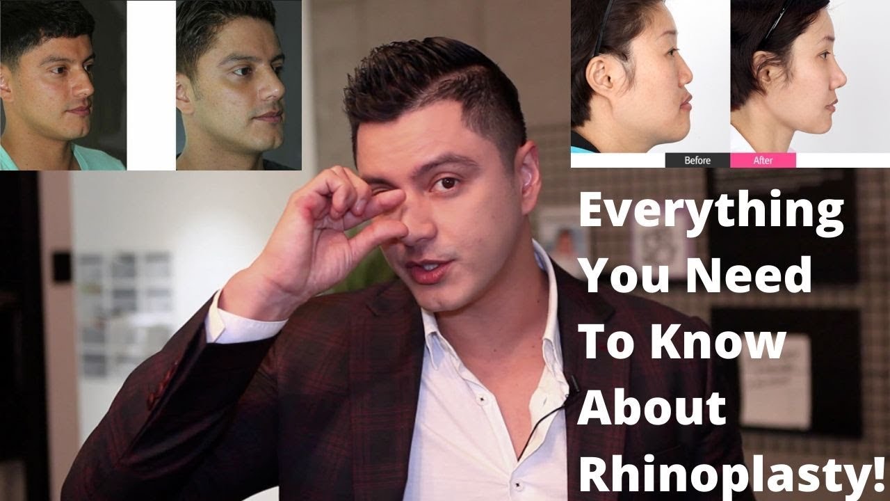 Everything You Need To Know About Rhinoplasty In Korea | Tony Medina