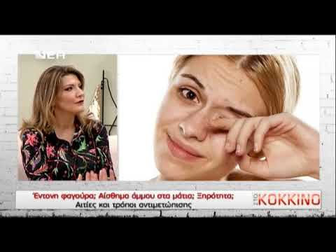 Βίντεο: Γιατί το αριστερό μάτι φαγούρα