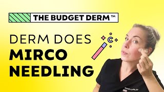 Dermatologist does athome Microneedling! | Pros + Cons vs. Inoffice treatment