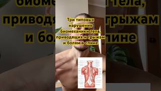 Три Боли Твоей Спины | #йога #лфк #позвоночник #здороваяспина #здоровье #спорт