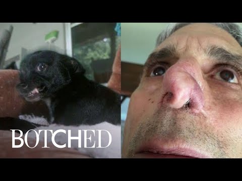 My Name Is Jim, and My Dog Ate My Nose | Botched | E!
