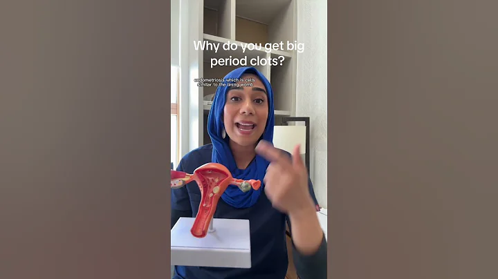 Big #period clot is no small matter and what the underlying condition that need to be checked out