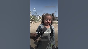 Thumbnail of Palestinian girl cries in pain after being displaced in north Gaza | AJ #shorts