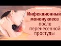 Инфекционный мононуклеоз, после перенесенной простуды