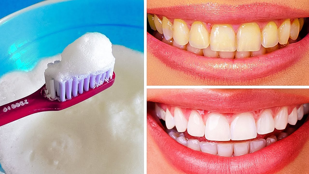 簡単に歯を白くする方法