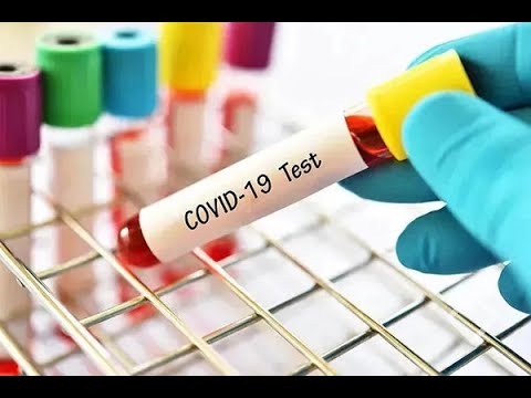 კორონავირუსით ინფიცირებულთა რიცხვი 14-ით გაიზარდა