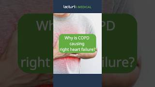 COPD and Heart Failure: What's the Connection? ❤ #COPD #HeartHealth #usmlestep
