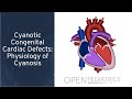 "Cyanotic Congenital Cardiac Defects: Physiology of Cyanosis" by Tom Kulik for OPENPediatrics