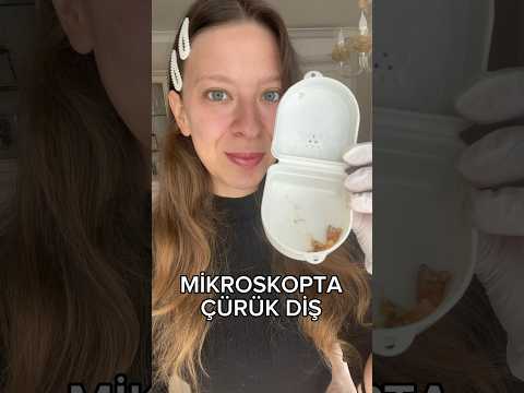 MİKROSKOPTA ÇÜRÜK DİŞ 🦷