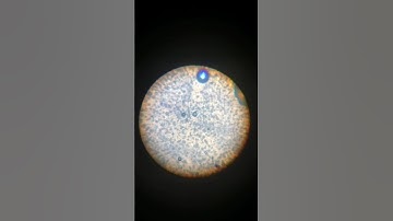 Egg yolk under a microscope