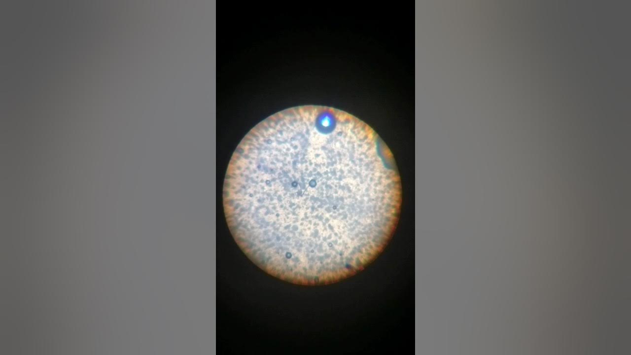 Egg yolk under a microscope YouTube