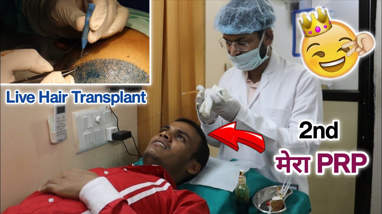 Hair Transplant Bhopal City Best Hair Transplant Clinic In India | 2nd PRP Hair  Transplant Results - YouTube