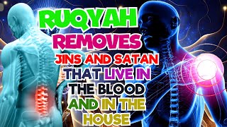 Ruqyah from the Qur'an and Sunnah To cure witchcraft, evil eye, and envy, Insha Allah