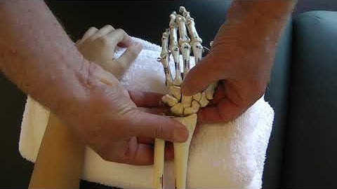 page 79 Radiocarpal Jt Dorsal Glide of the Lunate on the Radius