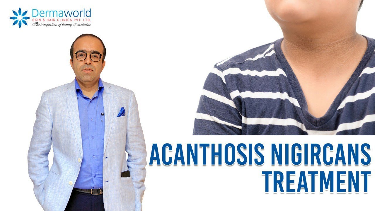 gyomorrák acanthosis nigricans