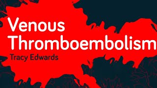Venous Thromboembolism - Tracy Edwards | Ausmed Course