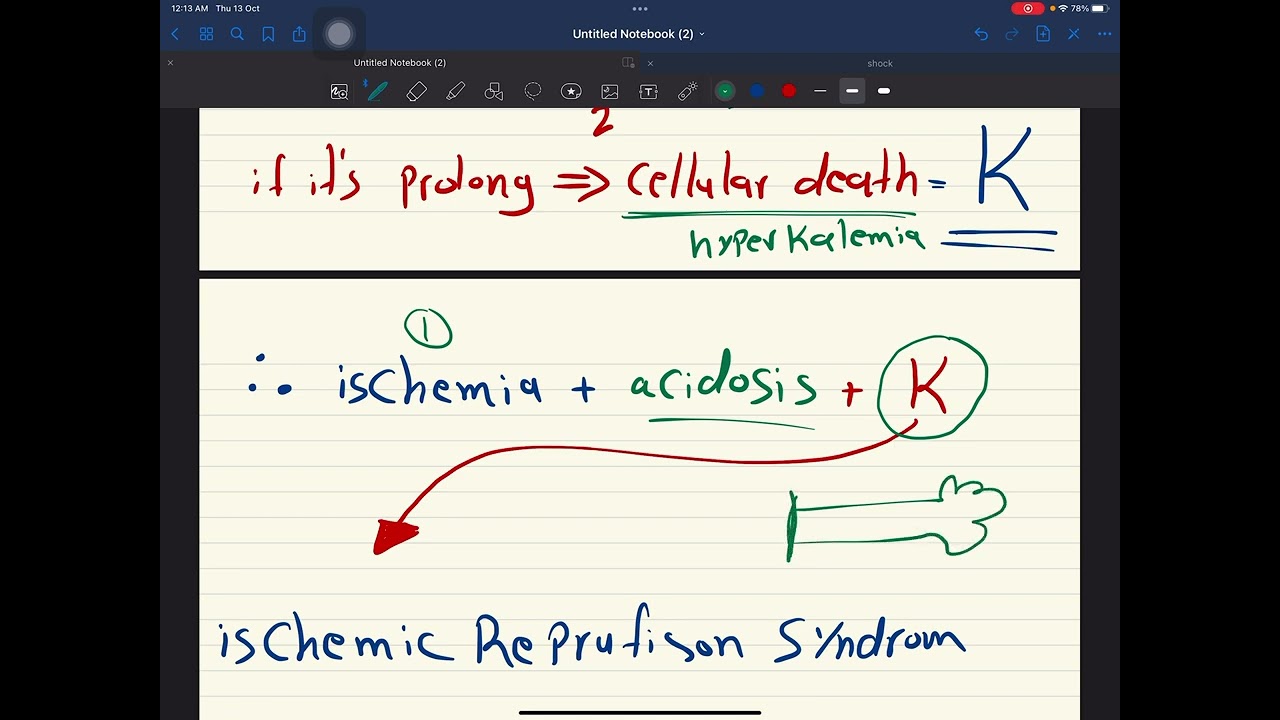 محاضره الجراحة shock-مرحله ثالثة/ طب الانبار