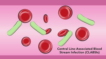 Central line catheters in children: common complications and infection prevention strategies