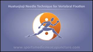 Huatuojiaji Point Needling for a Vertebral Fixation screenshot 5