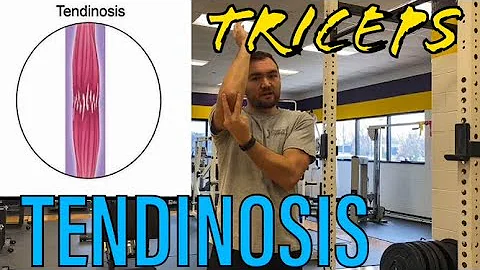Triceps Tendinosis Exercise and Pathophysiology