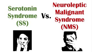 Serotonin Syndrome vs. Neuroleptic Malignant Syndrome | Similarities & Differences