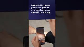 How do skin-checking apps work? - The Medical Futurist #shorts screenshot 1