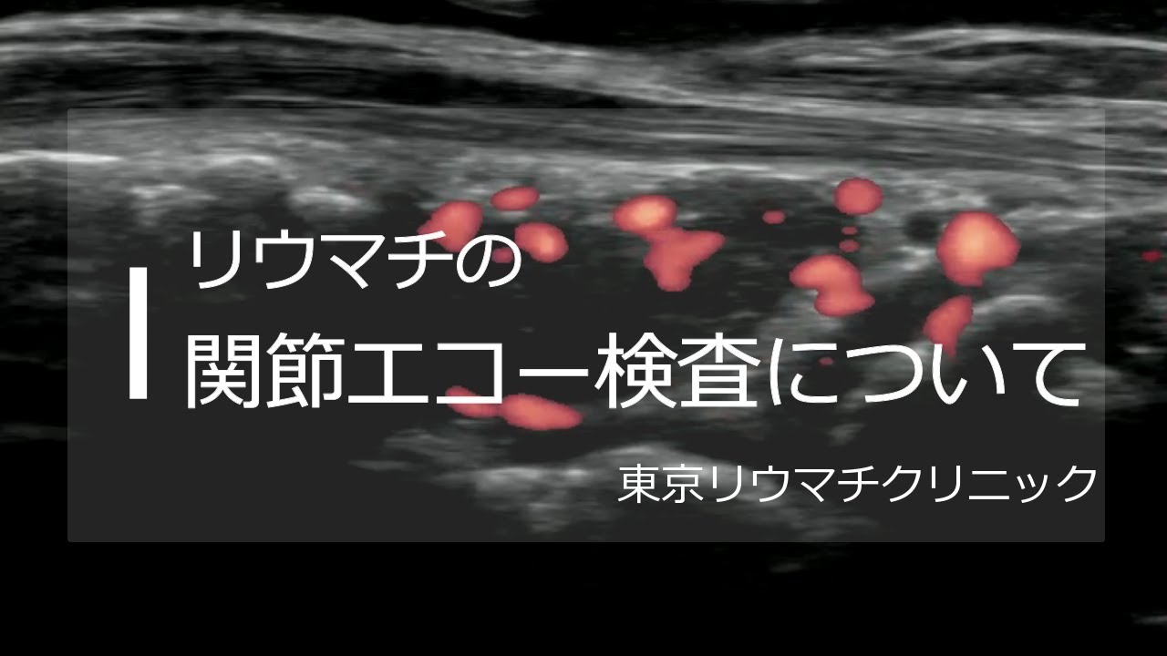 C – 反応性タンパク質