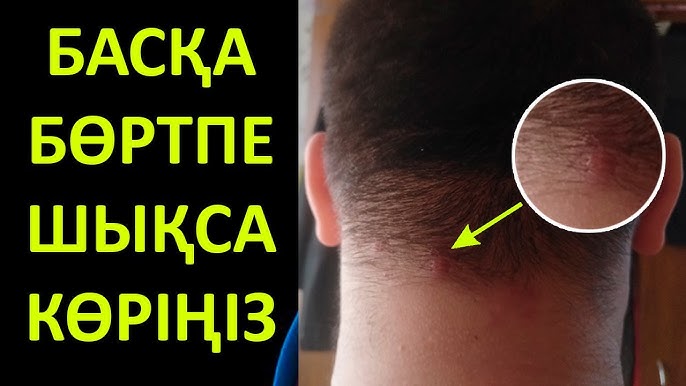 Реалити-шоудағы секс 2 видео BBW порно фотосуреттер