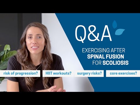 Exercising after SPINAL FUSION - Answering YOUR Scoliosis Questions w Physio Alex