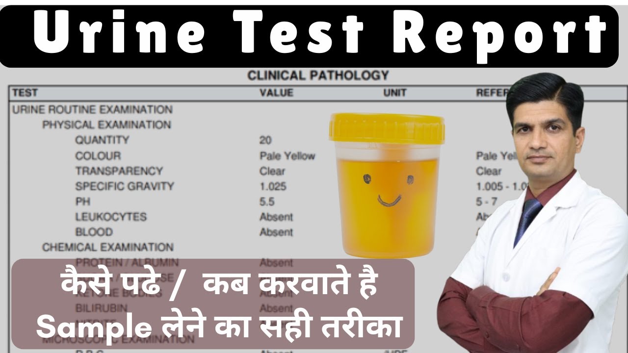 Urine Test Report कैसे पढ़ें? | Kidney, Infection, Sugar सब पता चलेगा!