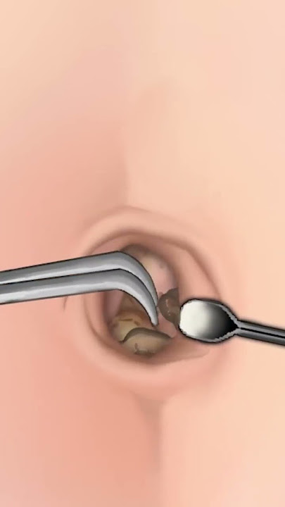 ASMR Navel Stone Belly Button Ring Removal