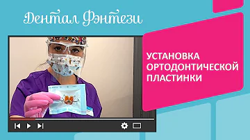 👉 Установка ортодонтической пластинки на зубы у детей