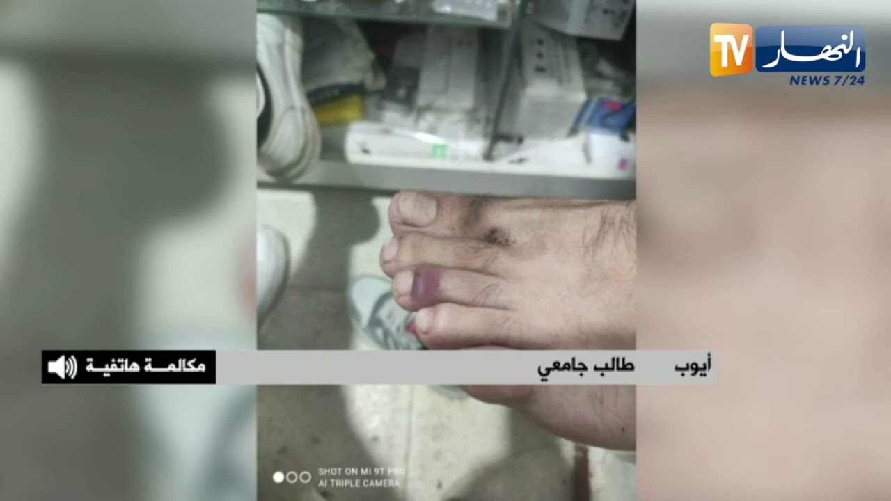 تصريح الطالب أيوب الذي تعرض إلى الإعتداء الجسدي من طرف أمن الجامعة