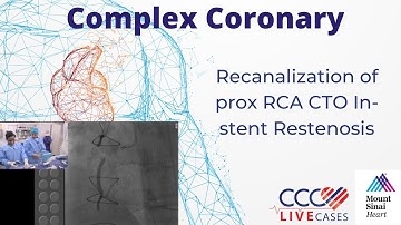 Recanalization of prox RCA CTO In-stent Restenosis - June 19, 2018