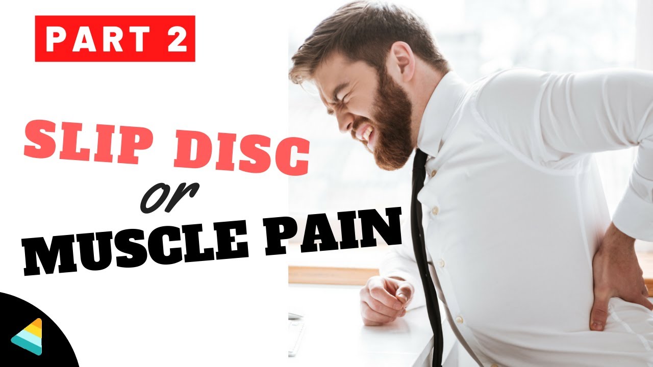 Back Pain in Hindi [Part 2/6] कमर दर्द के 3 महत्वपूर्ण कारण YouTube