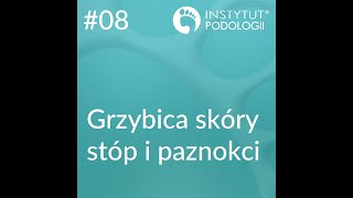 #08. Grzybica skóry stóp i paznokci